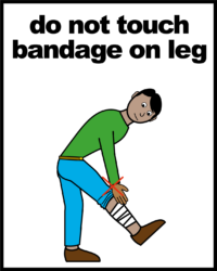 Do not touch bandage on leg