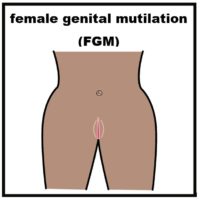 Thumbnail for Female Genital Mutilation