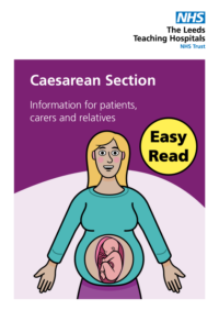 Thumbnail for Caesarean Section (Easy Read)