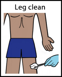 Bone biopsy leg clean skin